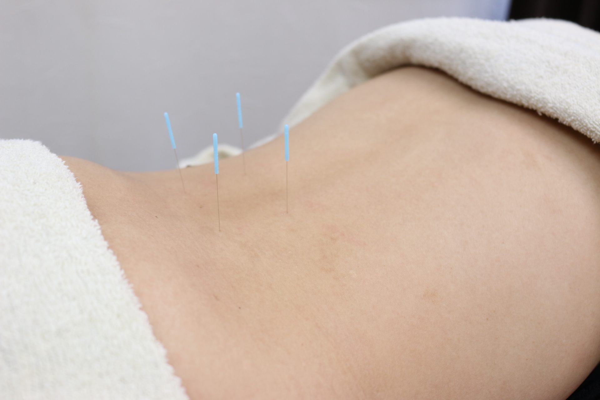 アフターケア指導の様子